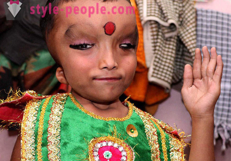 Az indiai falu imádták fiú egy torz fej, mint egy isten Ganesha