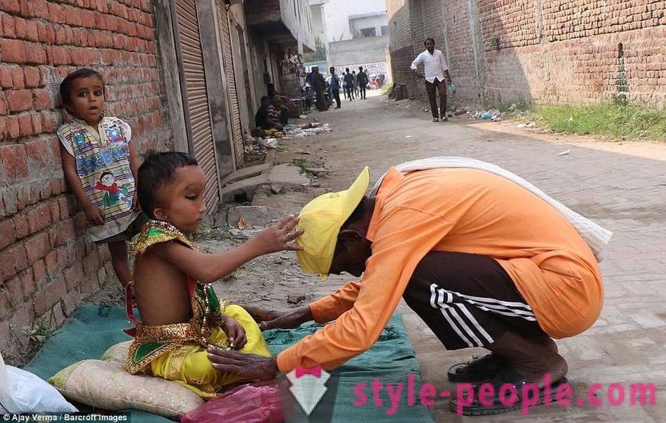 Az indiai falu imádták fiú egy torz fej, mint egy isten Ganesha