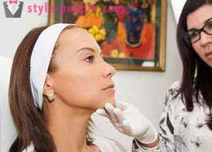 Peeling arc kalcium-klorid: értékelés