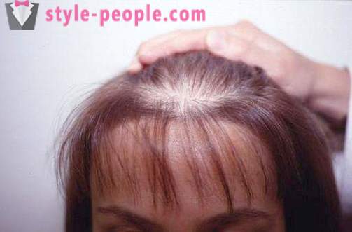 Darsonval haj. Alkalmazás darsonvalya kezelésére és megelőzésére hajhullás